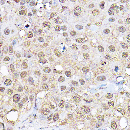 p70 S6 Kinase Antibody in Immunohistochemistry (Paraffin) (IHC (P))