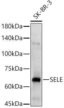 CD62E (E-selectin) Antibody in Western Blot (WB)