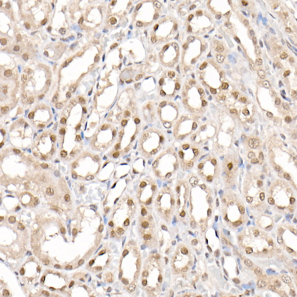 PRMT4 Antibody in Immunohistochemistry (Paraffin) (IHC (P))