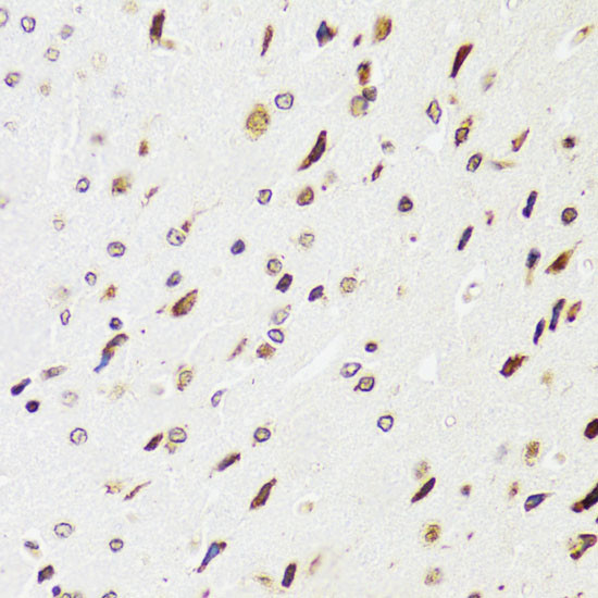 EDF1 Antibody in Immunohistochemistry (Paraffin) (IHC (P))