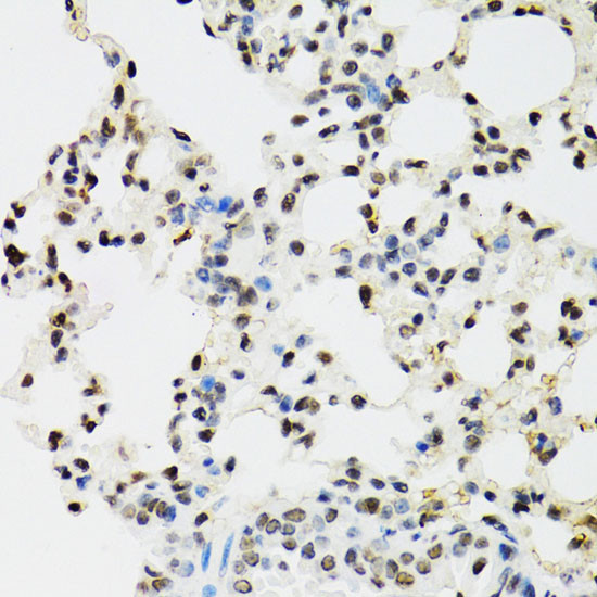 EDF1 Antibody in Immunohistochemistry (Paraffin) (IHC (P))