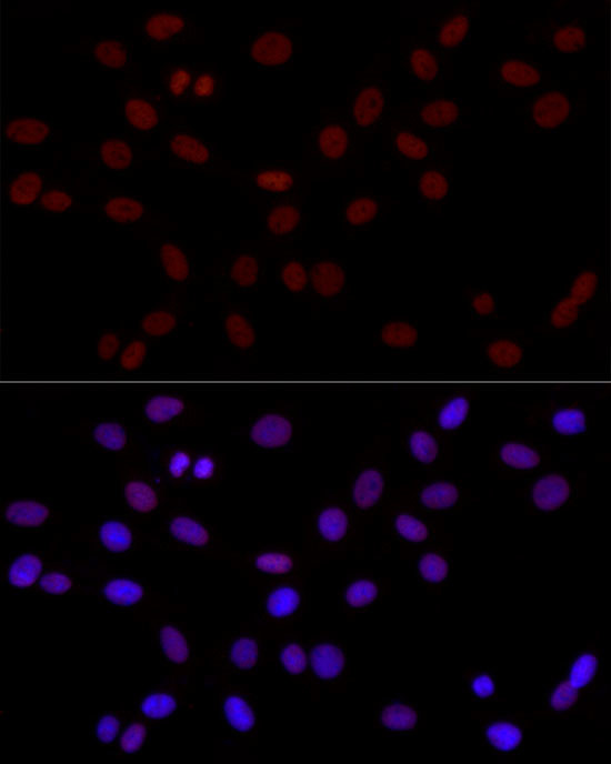 H3K4me2 Antibody in Immunocytochemistry (ICC/IF)