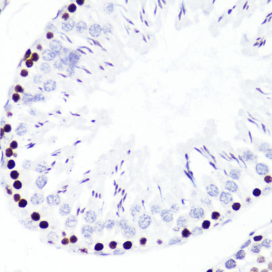 H3K4me2 Antibody in Immunohistochemistry (Paraffin) (IHC (P))