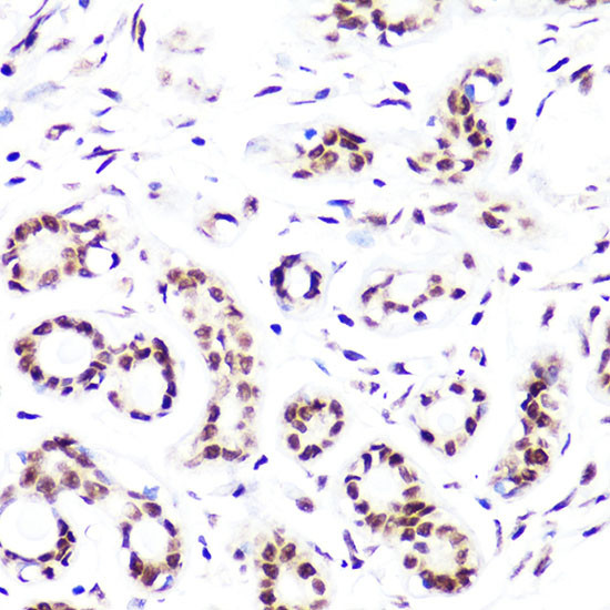 H3K4me2 Antibody in Immunohistochemistry (Paraffin) (IHC (P))