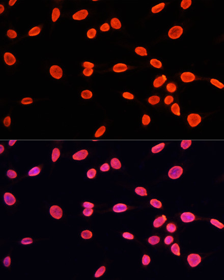 H3K9me1 Antibody in Immunocytochemistry (ICC/IF)