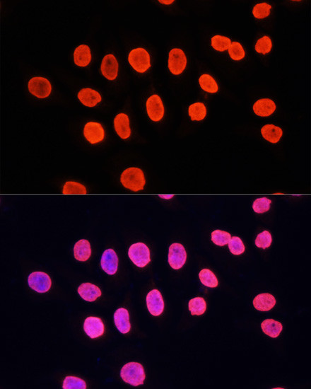 H3K9me1 Antibody in Immunocytochemistry (ICC/IF)