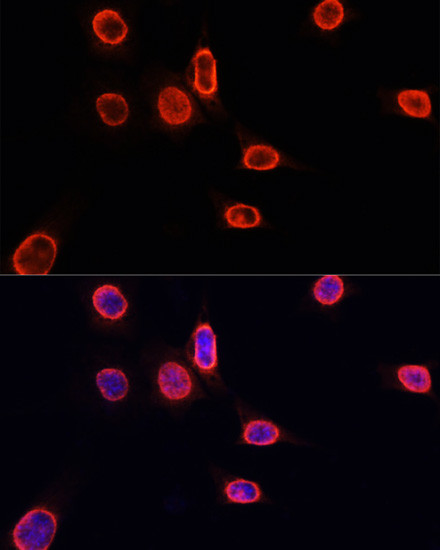 H3K9me1 Antibody in Immunocytochemistry (ICC/IF)