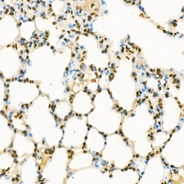 H3K9me1 Antibody in Immunohistochemistry (Paraffin) (IHC (P))