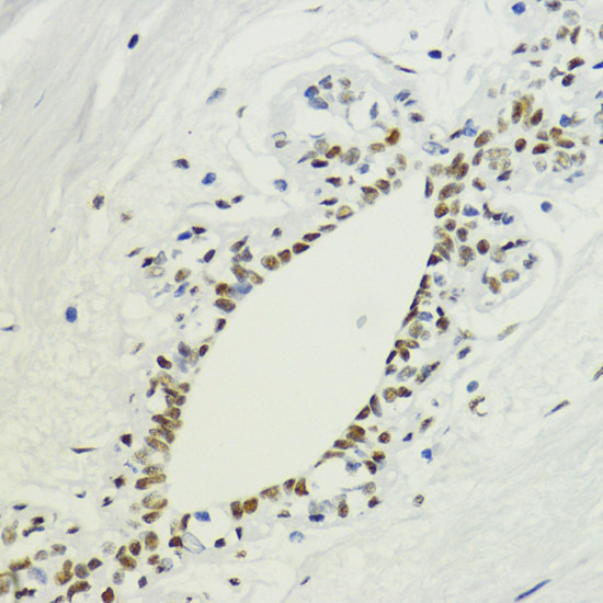 H3K36me2 Antibody in Immunohistochemistry (Paraffin) (IHC (P))