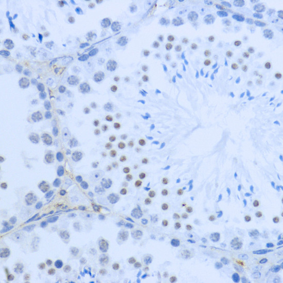 H3K36me2 Antibody in Immunohistochemistry (Paraffin) (IHC (P))