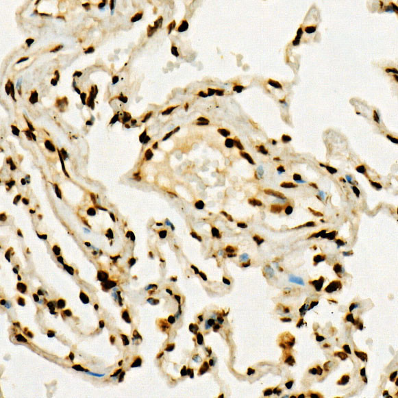 H3K36me3 Antibody in Immunohistochemistry (Paraffin) (IHC (P))