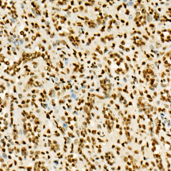 H3K36me3 Antibody in Immunohistochemistry (Paraffin) (IHC (P))