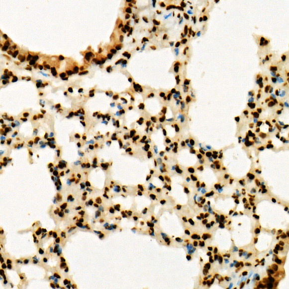 H3K36me3 Antibody in Immunohistochemistry (Paraffin) (IHC (P))