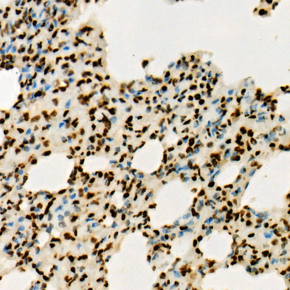 H3K36me3 Antibody in Immunohistochemistry (Paraffin) (IHC (P))