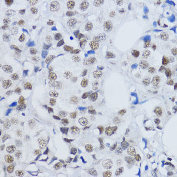 H3K79me2 Antibody in Immunohistochemistry (Paraffin) (IHC (P))