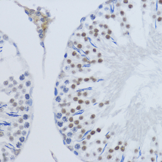 H3K79me2 Antibody in Immunohistochemistry (Paraffin) (IHC (P))