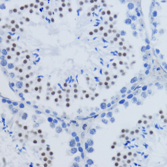 H3K79me2 Antibody in Immunohistochemistry (Paraffin) (IHC (P))