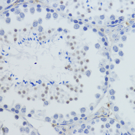 H4K20me3 Antibody in Immunohistochemistry (Paraffin) (IHC (P))