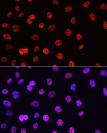 H3R17me2a Antibody in Immunocytochemistry (ICC/IF)