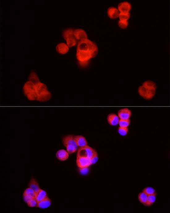 SQLE Antibody in Immunocytochemistry (ICC/IF)