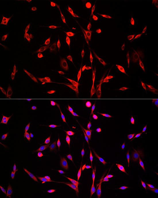 SQLE Antibody in Immunocytochemistry (ICC/IF)