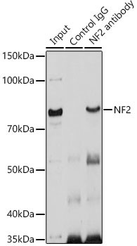 NF2 Antibody in Immunoprecipitation (IP)