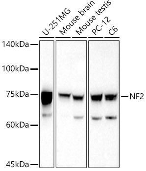 NF2 Antibody in Western Blot (WB)