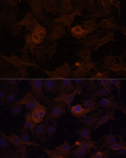 Filamin B Antibody in Immunocytochemistry (ICC/IF)