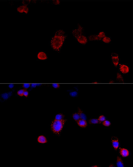 Filamin B Antibody in Immunocytochemistry (ICC/IF)