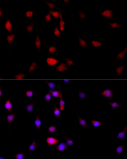 Filamin B Antibody in Immunocytochemistry (ICC/IF)