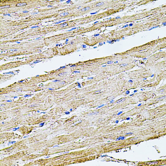 Filamin B Antibody in Immunohistochemistry (Paraffin) (IHC (P))