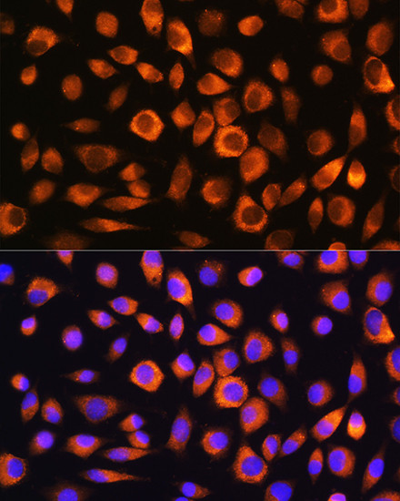 HSC70 Antibody in Immunocytochemistry (ICC/IF)