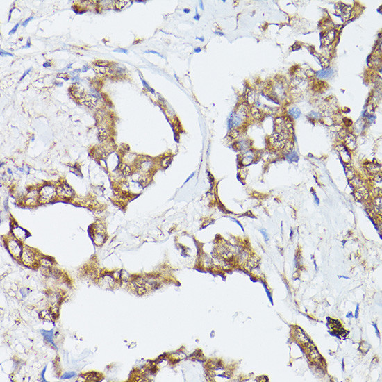 HSC70 Antibody in Immunohistochemistry (Paraffin) (IHC (P))