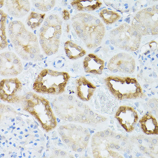 HSC70 Antibody in Immunohistochemistry (Paraffin) (IHC (P))