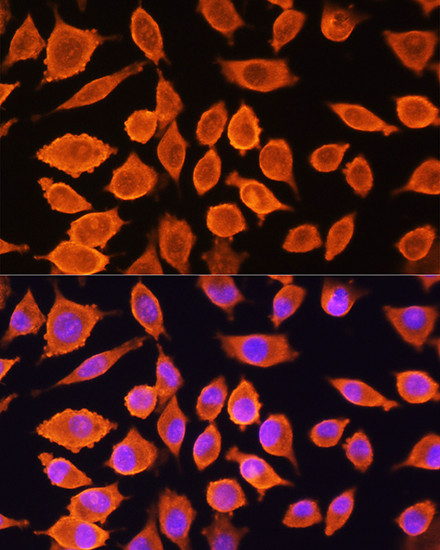 SIAH1 Antibody in Immunocytochemistry (ICC/IF)