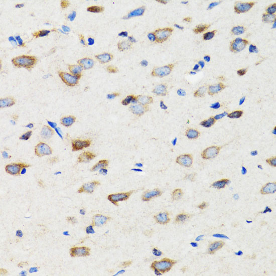 SIAH1 Antibody in Immunohistochemistry (Paraffin) (IHC (P))