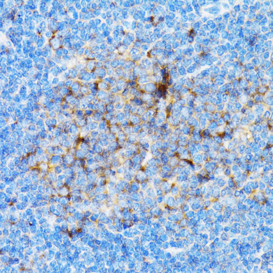 SIAH1 Antibody in Immunohistochemistry (Paraffin) (IHC (P))