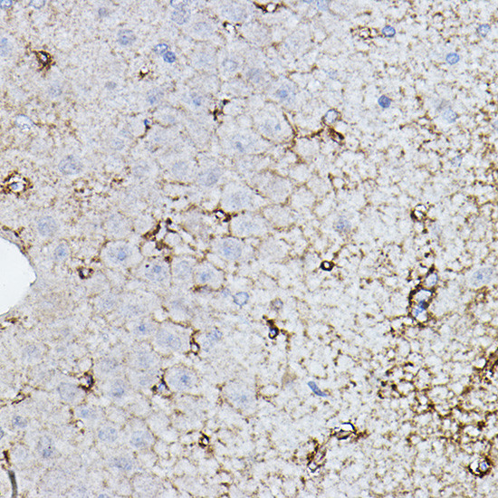 ChAT Antibody in Immunohistochemistry (Paraffin) (IHC (P))