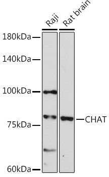 ChAT Antibody in Western Blot (WB)