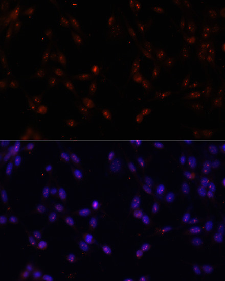 ILF3 Antibody in Immunocytochemistry (ICC/IF)