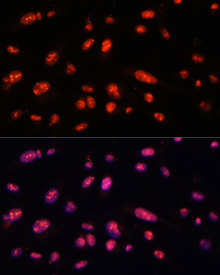 ILF3 Antibody in Immunocytochemistry (ICC/IF)