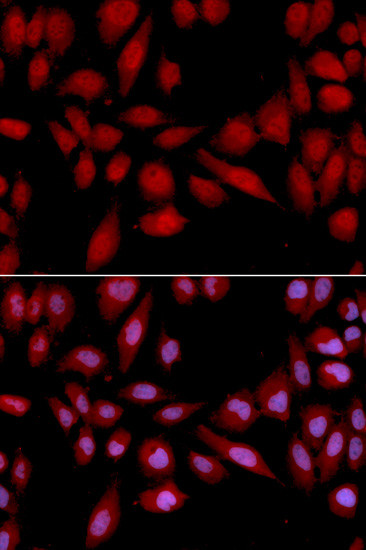 PSMA2 Antibody in Immunocytochemistry (ICC/IF)