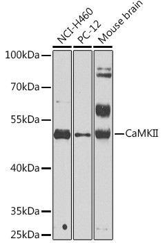 CaMKII beta Antibody in Western Blot (WB)