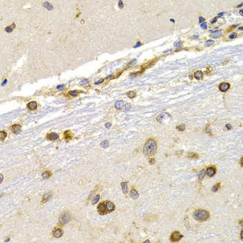 EEF1D Antibody in Immunohistochemistry (Paraffin) (IHC (P))