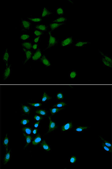 PSMA1 Antibody in Immunocytochemistry (ICC/IF)