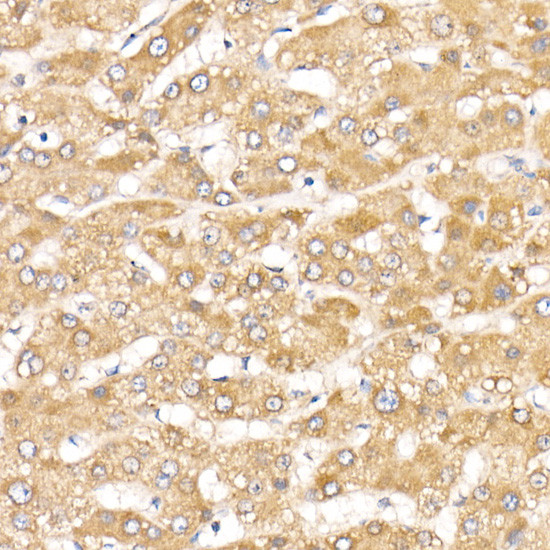 ACK1 Antibody in Immunohistochemistry (Paraffin) (IHC (P))