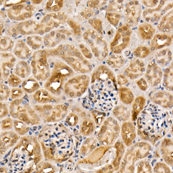 ACK1 Antibody in Immunohistochemistry (Paraffin) (IHC (P))