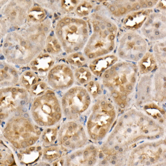 ACK1 Antibody in Immunohistochemistry (Paraffin) (IHC (P))