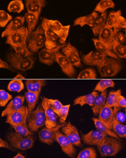 RPS3 Antibody in Immunocytochemistry (ICC/IF)