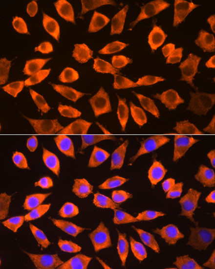 RPS3 Antibody in Immunocytochemistry (ICC/IF)